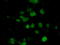 EMG1 N1-Specific Pseudouridine Methyltransferase antibody, LS-C115237, Lifespan Biosciences, Immunofluorescence image 