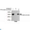 Protein Phosphatase, Mg2+/Mn2+ Dependent 1B antibody, LS-C812976, Lifespan Biosciences, Immunoprecipitation image 