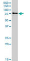 Interleukin 1 Receptor Associated Kinase 3 antibody, LS-C139498, Lifespan Biosciences, Western Blot image 