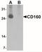 CD160 Molecule antibody, NBP2-41234, Novus Biologicals, Western Blot image 