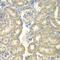 Acyl-CoA Synthetase Long Chain Family Member 5 antibody, LS-C335145, Lifespan Biosciences, Immunohistochemistry paraffin image 