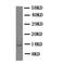Trefoil Factor 1 antibody, LS-C312842, Lifespan Biosciences, Western Blot image 