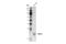 Twist Family BHLH Transcription Factor 1 antibody, 46702S, Cell Signaling Technology, Western Blot image 