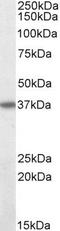 FAS antibody, PA5-19198, Invitrogen Antibodies, Western Blot image 