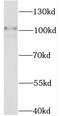 Signal Transducer And Activator Of Transcription 6 antibody, FNab08308, FineTest, Western Blot image 