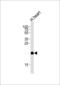 ORMDL Sphingolipid Biosynthesis Regulator 2 antibody, 55-440, ProSci, Western Blot image 