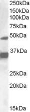 Nuclear receptor subfamily 1 group I member 2 antibody, EB09172, Everest Biotech, Western Blot image 