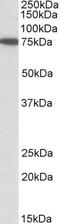 Sorting Nexin 1 antibody, PA5-19239, Invitrogen Antibodies, Western Blot image 