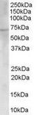 Choline O-Acetyltransferase antibody, GTX89623, GeneTex, Western Blot image 