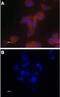 Transient Receptor Potential Cation Channel Subfamily V Member 6 antibody, PA5-77321, Invitrogen Antibodies, Immunocytochemistry image 