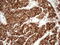 SHMT antibody, M03233, Boster Biological Technology, Immunohistochemistry paraffin image 