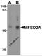 Major Facilitator Superfamily Domain Containing 2A antibody, 6025, ProSci, Western Blot image 