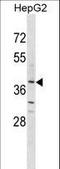 Olfactory Receptor Family 2 Subfamily K Member 2 antibody, LS-C158464, Lifespan Biosciences, Western Blot image 