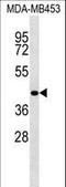 RNA Binding Motif Protein 4 antibody, LS-C162499, Lifespan Biosciences, Western Blot image 