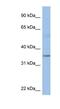 Potassium Channel Tetramerization Domain Containing 4 antibody, NBP1-80208, Novus Biologicals, Western Blot image 