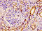 Patatin Like Phospholipase Domain Containing 6 antibody, LS-C671712, Lifespan Biosciences, Immunohistochemistry paraffin image 