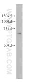 Kelch Like Family Member 13 antibody, 15612-1-AP, Proteintech Group, Western Blot image 