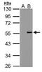 Protein Phosphatase 4 Regulatory Subunit 2 antibody, PA5-31932, Invitrogen Antibodies, Western Blot image 