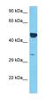 Sorting Nexin 16 antibody, orb326219, Biorbyt, Western Blot image 