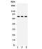 Autophagy Related 7 antibody, R31845, NSJ Bioreagents, Western Blot image 