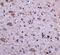 Immunity Related GTPase M antibody, A03614, Boster Biological Technology, Immunohistochemistry paraffin image 