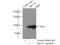 BRCA1 DNA Repair Associated antibody, 20649-1-AP, Proteintech Group, Immunoprecipitation image 