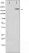 FA Complementation Group D2 antibody, abx010765, Abbexa, Western Blot image 