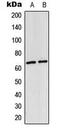 p65 antibody, MBS8213602, MyBioSource, Western Blot image 