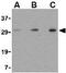 TP53 Induced Glycolysis Regulatory Phosphatase antibody, GTX31306, GeneTex, Western Blot image 