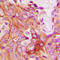 Protein Kinase C Beta antibody, LS-C368481, Lifespan Biosciences, Immunohistochemistry frozen image 
