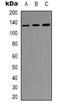 Protein Tyrosine Kinase 2 antibody, LS-C368815, Lifespan Biosciences, Western Blot image 