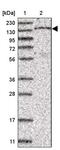 Stromal Antigen 1 antibody, PA5-57115, Invitrogen Antibodies, Western Blot image 