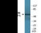 Ribosomal Protein S6 Kinase B1 antibody, EKC2097, Boster Biological Technology, Western Blot image 