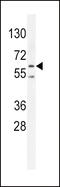 Protein Kinase AMP-Activated Catalytic Subunit Alpha 2 antibody, 55-462, ProSci, Western Blot image 