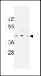 Pre-MRNA Processing Factor 38A antibody, MBS9202046, MyBioSource, Western Blot image 