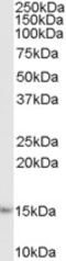 Calcium Voltage-Gated Channel Auxiliary Subunit Alpha2delta 1 antibody, 45-350, ProSci, Western Blot image 
