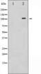 RB Transcriptional Corepressor 1 antibody, abx011464, Abbexa, Western Blot image 