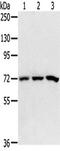 Signal Recognition Particle 68 antibody, TA351671, Origene, Western Blot image 