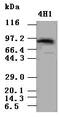 Signal Transducer And Activator Of Transcription 5A antibody, GTX83547, GeneTex, Western Blot image 