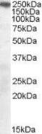 SORL1 antibody, GTX89685, GeneTex, Western Blot image 