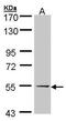 UGP1 antibody, GTX107967, GeneTex, Western Blot image 