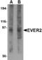 Transmembrane Channel Like 8 antibody, LS-C53323, Lifespan Biosciences, Western Blot image 