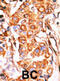 Glycerol kinase 2 antibody, abx025069, Abbexa, Western Blot image 