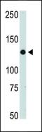 Janus Kinase 2 antibody, PA5-11267, Invitrogen Antibodies, Western Blot image 