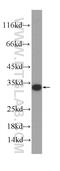 ATP Synthase F1 Subunit Gamma antibody, 60284-1-Ig, Proteintech Group, Western Blot image 