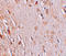 WIZ Zinc Finger antibody, A05707, Boster Biological Technology, Immunohistochemistry paraffin image 