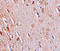 Protein Wiz antibody, A05707, Boster Biological Technology, Immunohistochemistry paraffin image 