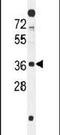 SWI5 Dependent Homologous Recombination Repair Protein 1 antibody, PA5-24555, Invitrogen Antibodies, Western Blot image 