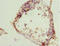 Zinc Finger C3HC-Type Containing 1 antibody, LS-C676733, Lifespan Biosciences, Immunohistochemistry paraffin image 