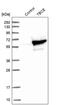 Tubulin Folding Cofactor E antibody, PA5-55341, Invitrogen Antibodies, Western Blot image 